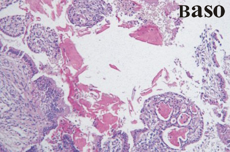 Mucicamine Stain